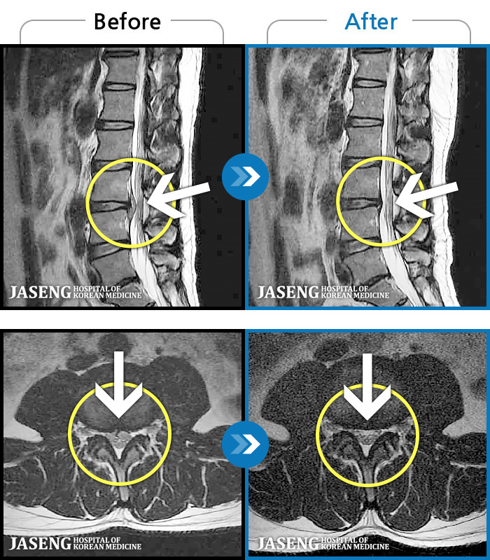 ڻѹ溴 ġ MRI ġ-ġ ٸ , .