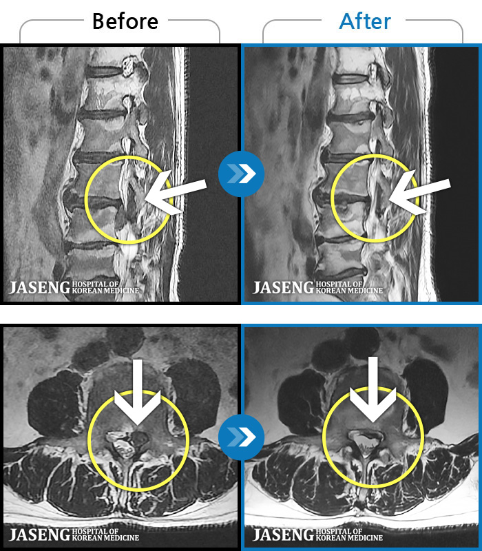 ڻѹ溴 ġ MRI ġ-㸮 Ͽ ϻȰ ¿ϴ.