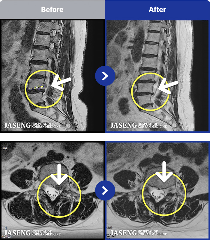 �����ڻ����ǿ� ġ���� MRI�� ���� ġ����-�㸮�� �ʹ� ������ �ٸ��� ������