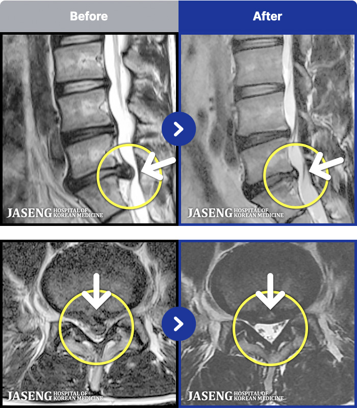 �ڻ��ѹ溴�� ġ���� MRI�� ���� ġ����-���� �㸮 ������ ���� ����� ���� 