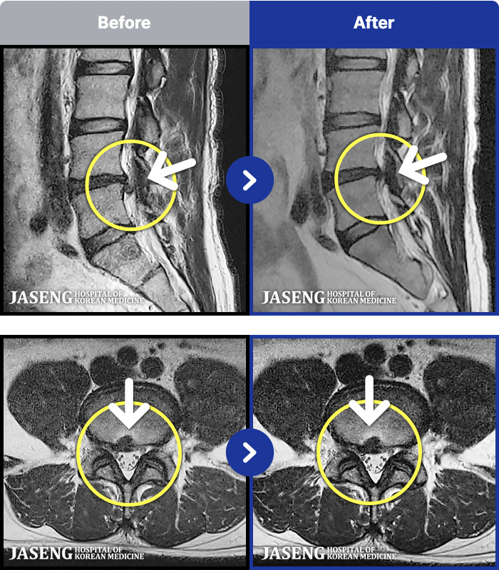 �ڻ��ѹ溴�� ġ���� MRI�� ���� ġ����-���� ��� ������ ���ϰ� ���� ������ ���� �� ������ ���ӵǸ� ���� ������ �ٷ� �� ���� ����
