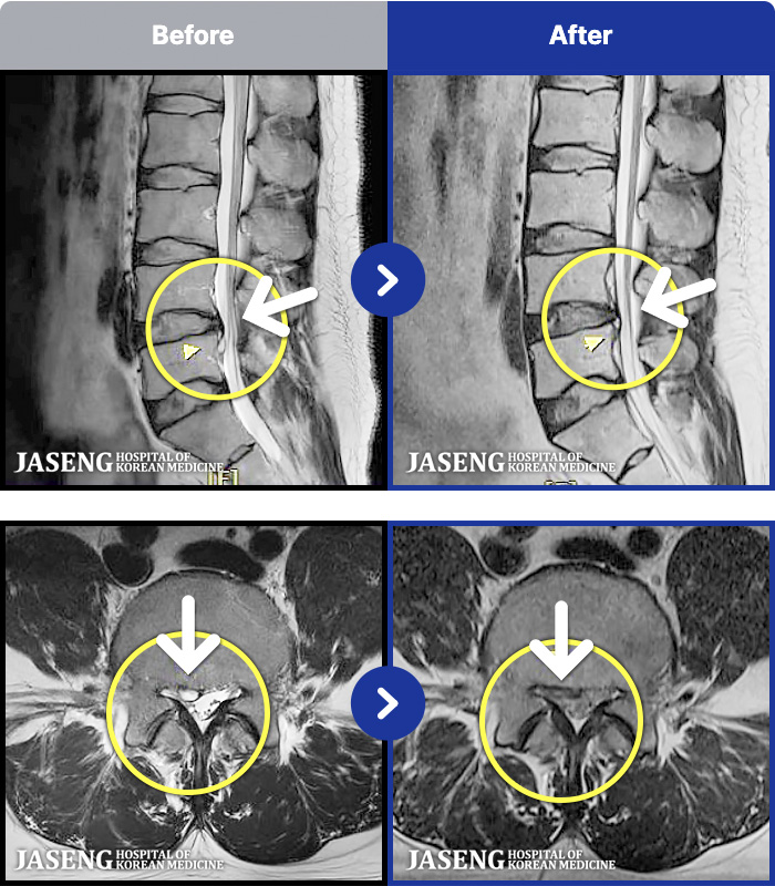 ڻѹ溴 ġ MRI ġ- 㸮 , ̾ ȭǾ ϼ̽ϴ.