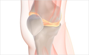 부천자생한방병원 무릎질환 무릎점액낭염-무릎점액낭염 관련 사진 입니다.