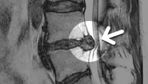 MRI ���� ���5