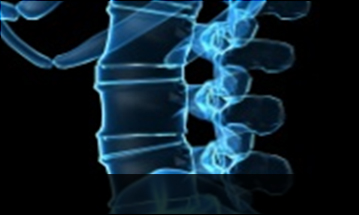 부천자생한방병원 허리질환 척추전방전위증-정상적인 사람의 척추뼈 모습입니다.